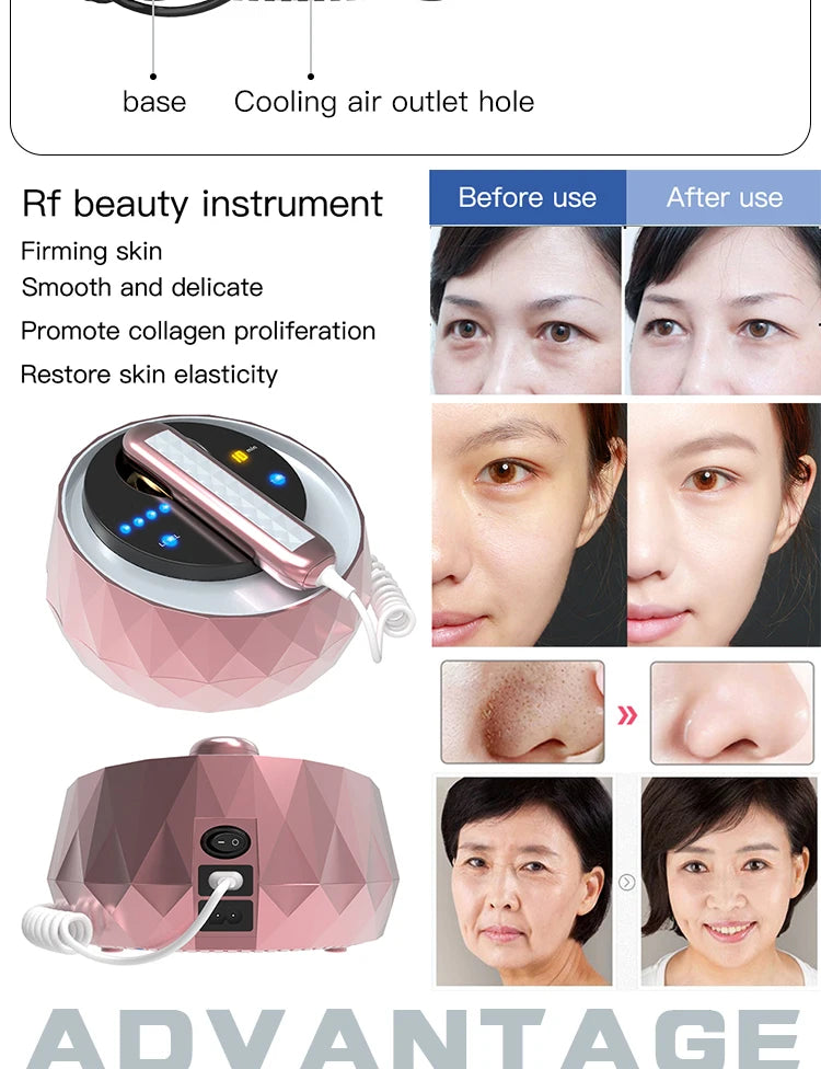 Portable RF Skin Tightening Device Radio Frequency Wrinkle Reduction Anti Aging Facial Skincare Machine for Home Use